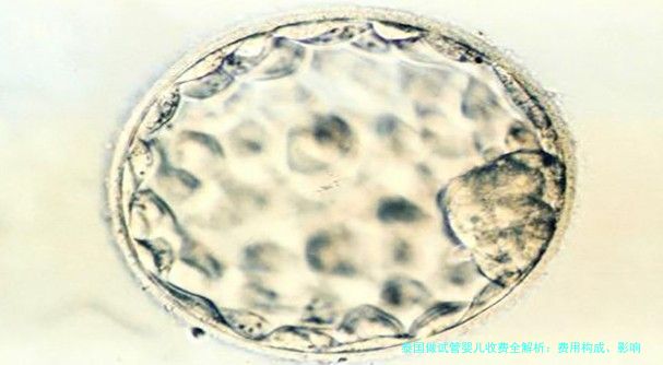泰国做试管婴儿收费全解析：费用构成、影响因素及省钱技巧