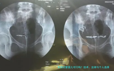 美国试管婴儿可行吗？技术、法律与个人选择的全面解析