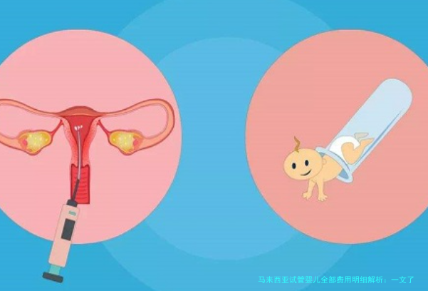 马来西亚试管婴儿全部费用明细解析：一文了解所有开销