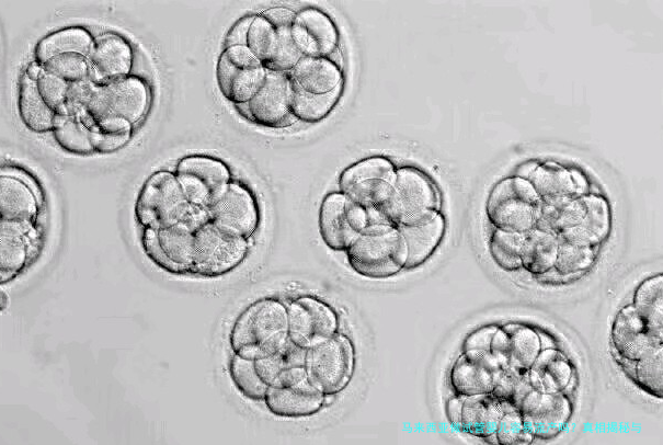 马来西亚做试管婴儿容易流产吗？真相揭秘与实用指南