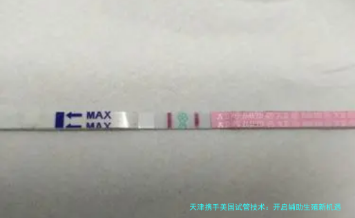 天津携手美国试管技术：开启辅助生殖新机遇