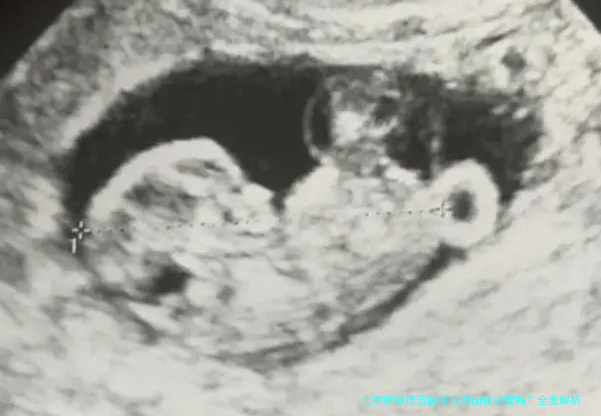 北京家恩德运医院在美国做试管吗？全面解析与建议