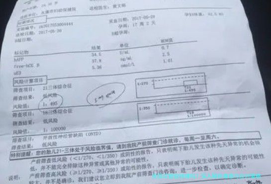 美国试管取卵痛吗？深入解析痛感与应对策略