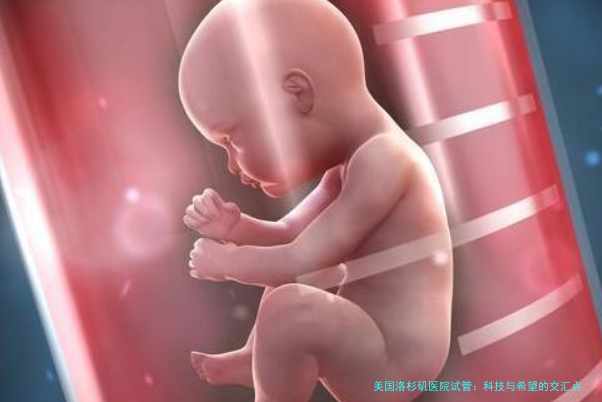 美国洛杉矶医院试管：科技与希望的交汇点