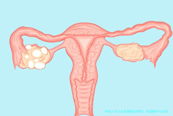 中国人可以去美国做试管吗？全面解析与实用建议