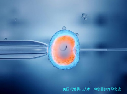 美国试管婴儿技术：助您圆梦好孕之旅