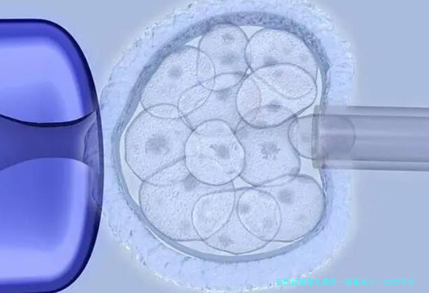 泰国试管婴儿费用一般是多少？2023年全面解析与省钱攻略