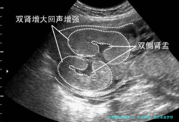 孕泰国际试管中心：专业助孕，圆您家庭梦想