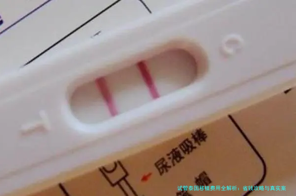 试管泰国移植费用全解析：省钱攻略与真实案例分享