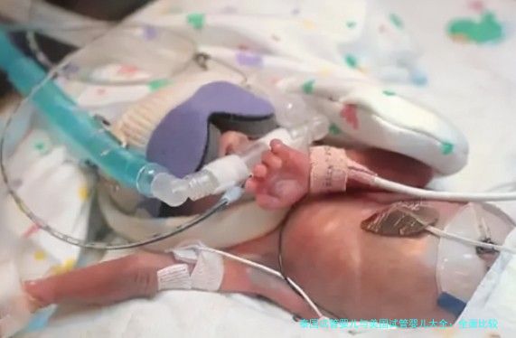 泰国试管婴儿与美国试管婴儿大全：全面比较与选择指南