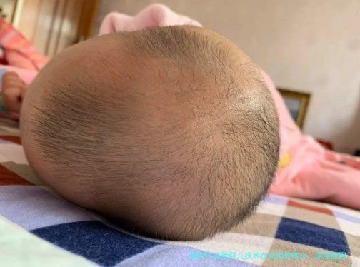 第四代试管婴儿技术在美国被禁止：深层原因与未来展望