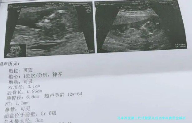 马来西亚第三代试管婴儿成功率和费用全解析