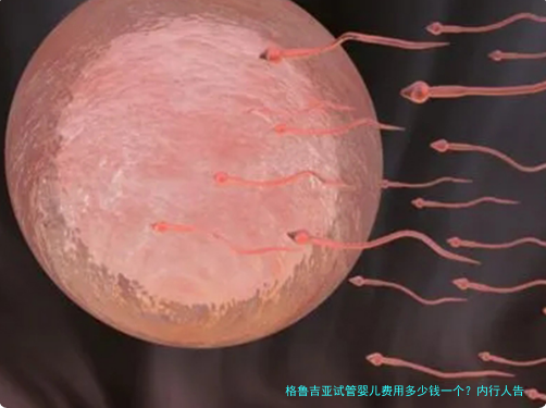 格鲁吉亚试管婴儿费用多少钱一个？内行人告诉你真实价格与避坑指南
