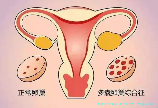 格鲁吉亚试管婴儿费用多少钱一次？真实价格大揭秘！