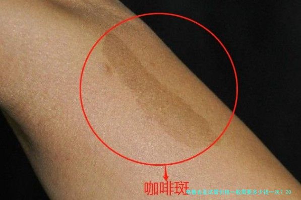 格鲁吉亚试管价格一般需要多少钱一次？2025费用明细与避坑指南