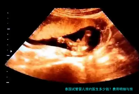 泰国试管婴儿预约医生多少钱？费用明细与预约避坑指南