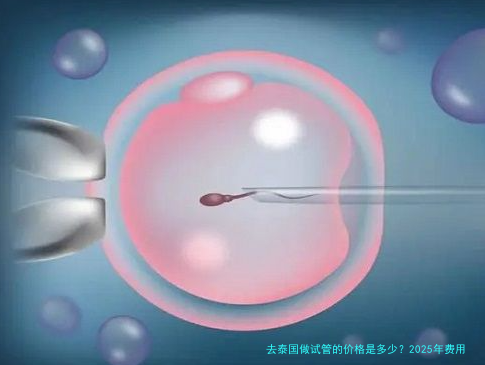 去泰国做试管的价格是多少？2025年费用明细和避坑经验