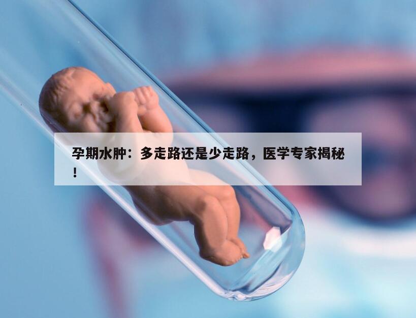 孕期水肿：多走路还是少走路，医学专家揭秘！