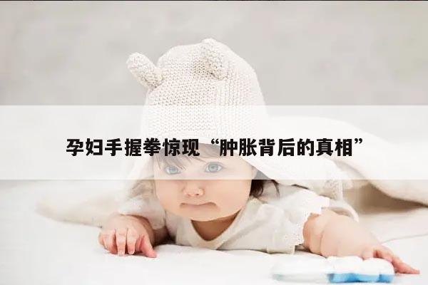 孕妇手握拳惊现“肿胀背后的真相”