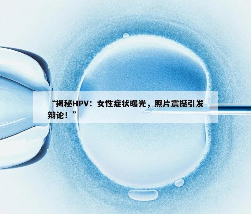 “揭秘HPV：女性症状曝光，照片震撼引发辩论！”