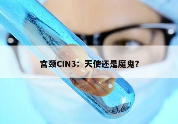 宫颈CIN3：天使还是魔鬼？