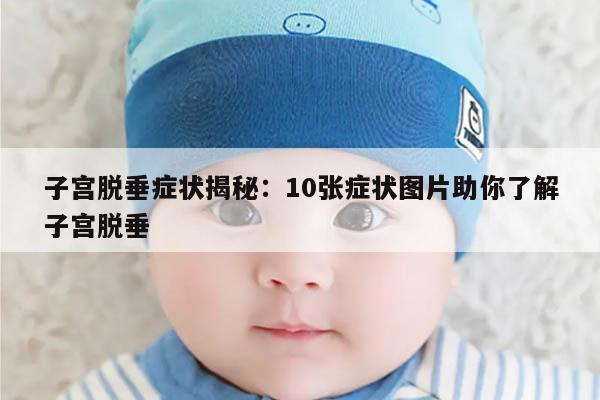 子宫脱垂症状揭秘：10张症状图片助你了解子宫脱垂