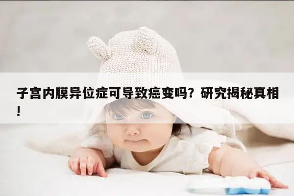 子宫内膜异位症可导致癌变吗？研究揭秘真相!