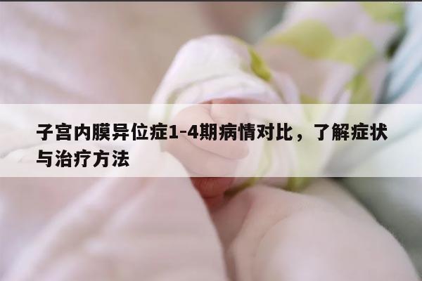 子宫内膜异位症1-4期病情对比，了解症状与治疗方法