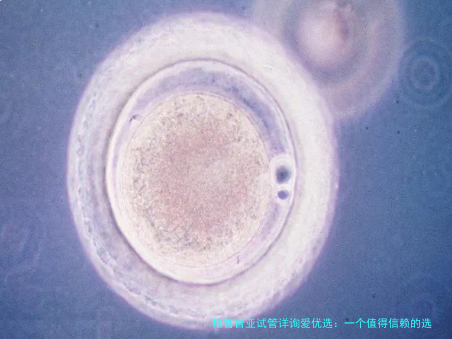 格鲁吉亚试管详询爱优选：一个值得信赖的选择