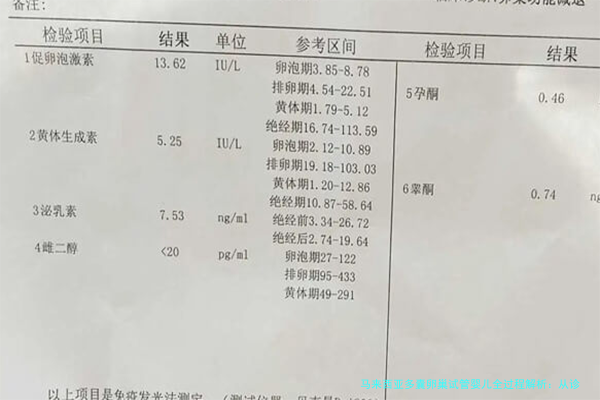 马来西亚多囊卵巢试管婴儿全过程解析：从诊断到成功之路