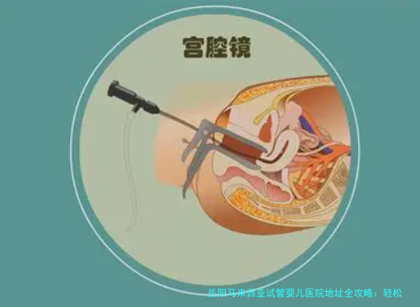 岳阳马来西亚试管婴儿医院地址全攻略：轻松找到优质助孕服务