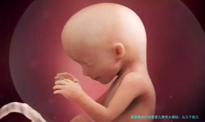 美国第四代试管婴儿费用大揭秘:从几千到几万,你准备好了吗?