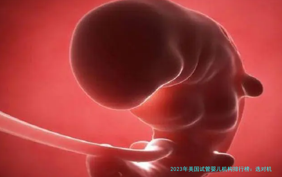 2023年美国试管婴儿机构排行榜:选对机构,助你圆梦!