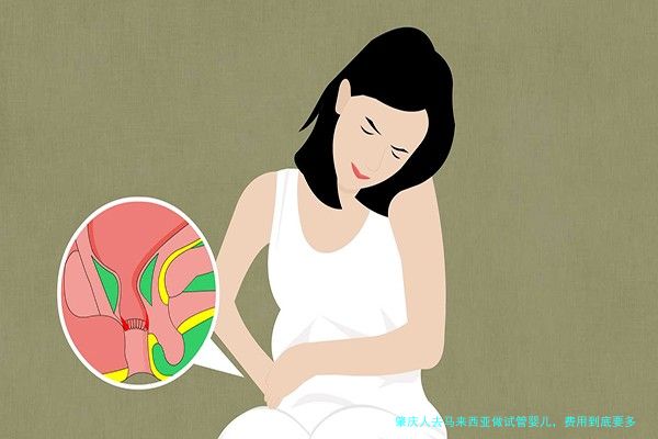 肇庆人去马来西亚做试管婴儿，费用到底要多少？全面解析