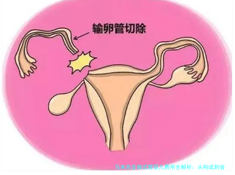 马来西亚做试管婴儿费用全解析：从构成到省钱技巧，一文看懂