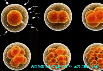 美国格鲁吉亚试管婴儿咨询：全方位指南与贴心建议