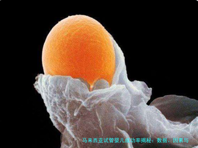 马来西亚试管婴儿成功率揭秘：数据、因素与提升技巧