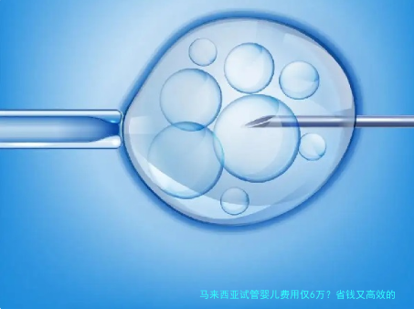 马来西亚试管婴儿费用仅6万？省钱又高效的生育选择