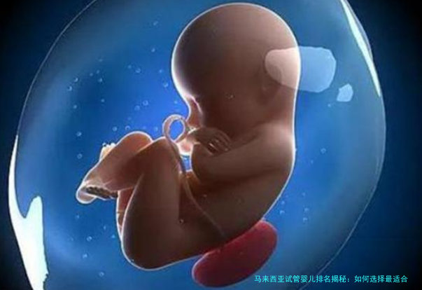 马来西亚试管婴儿排名揭秘：如何选择最适合你的诊所