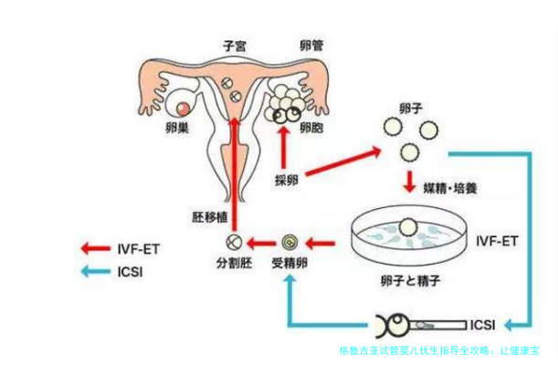 格鲁吉亚试管婴儿优生指导全攻略：让健康宝宝梦想成真