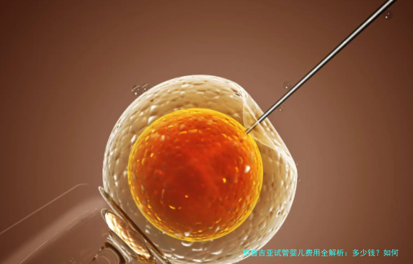 格鲁吉亚试管婴儿费用全解析：多少钱？如何省钱？