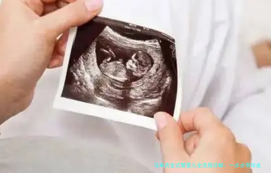 马来西亚试管婴儿全流程详解：一步步带你走向好孕