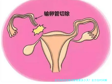 去马来西亚做试管需要多少天？全方位时间解析与实用指南