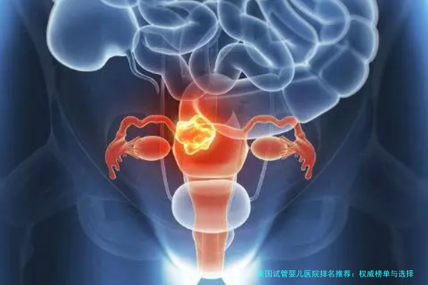 美国试管婴儿医院排名推荐：权威榜单与选择指南