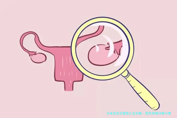 马来西亚试管婴儿全攻略：程序周期详解与费用透明分析
