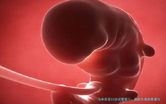 马来西亚53岁试管婴儿：高龄生育的希望与挑战