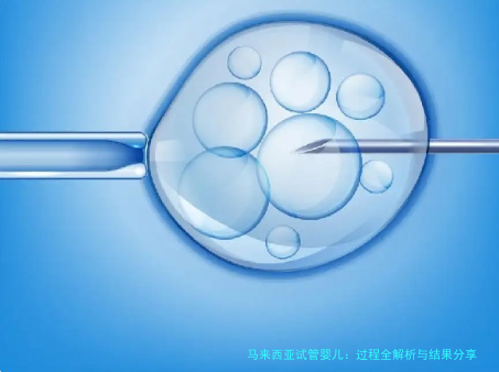 马来西亚试管婴儿：过程全解析与结果分享
