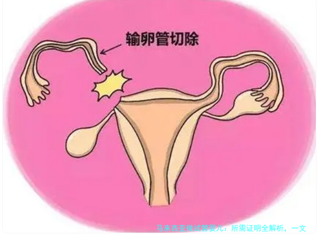 马来西亚做试管婴儿：所需证明全解析，一文搞定所有文件