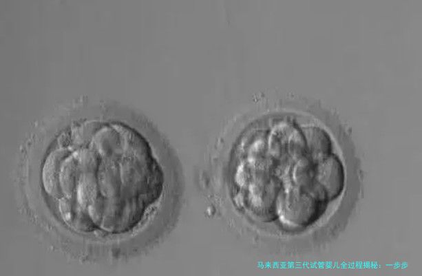 马来西亚第三代试管婴儿全过程揭秘：一步步带你了解具体过程