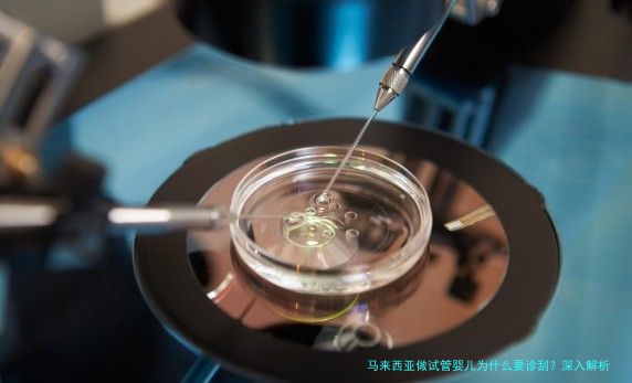 马来西亚做试管婴儿为什么要诊刮？深入解析诊刮的关键作用
